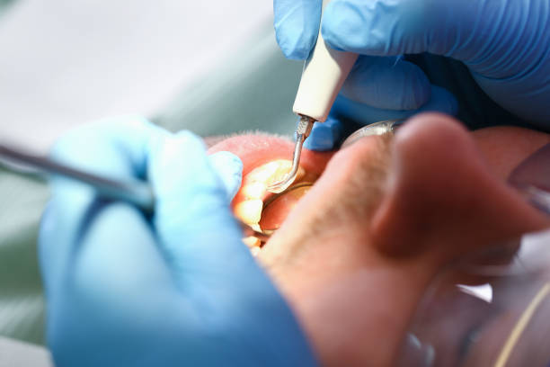 Best Emergency Denture Repair in Rutledge, TN