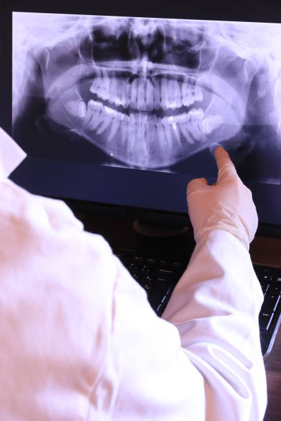 Best Emergency Dental Care for Broken or Chipped Teeth in Rutledge, TN