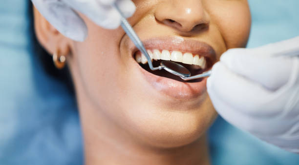 Best Emergency Wisdom Teeth Removal in Rutledge, TN