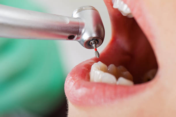Best Emergency TMJ Treatment in Rutledge, TN